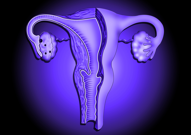 В США проводится полная диагностики и лесение опухолей матки, труб и яичников